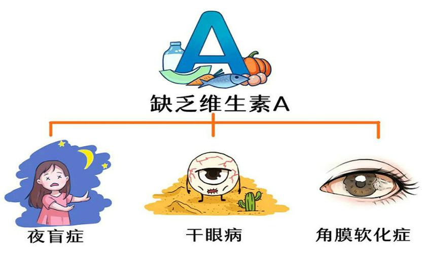 @近视的你 当心甜食正在悄悄损害你的视力